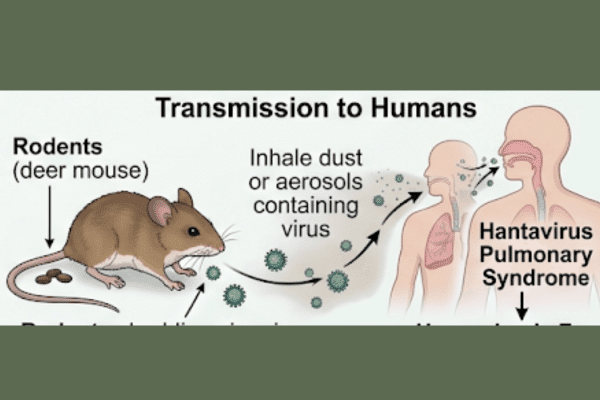 How Does Hantavirus Spread